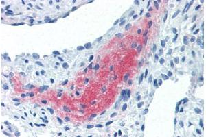 Human Uterus, Myometrium (formalin-fixed, paraffin-embedded) stained with LEFTY2 antibody ABIN337262 at 10 ug/ml followed by biotinylated anti-mouse IgG secondary antibody ABIN481714, alkaline phosphatase-streptavidin and chromogen. (LEFTY2 antibody)