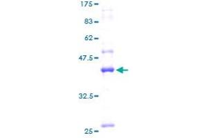 Aromatase Protein (AA 48-218) (GST tag)