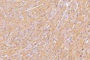 Immunohistochemistry analysis of paraffin-embedded mouse heart using,KIF5B (ABIN7074440) at dilution of 1: 1000 (KIF5B antibody)