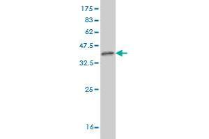 Western Blotting (WB) image for anti-Inhibitor of kappa Light Polypeptide Gene Enhancer in B-Cells, Kinase gamma (IKBKG) (AA 1-110) antibody (ABIN563665)