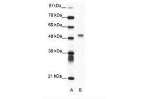Image no. 1 for anti-Friend Leukemia Virus Integration 1 (FLI1) (N-Term) antibody (ABIN202560) (FLI1 antibody  (N-Term))