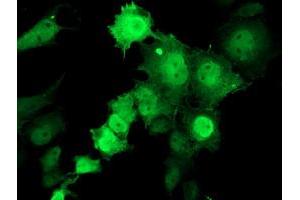 Anti-TMOD1 mouse monoclonal antibody (ABIN2454758) immunofluorescent staining of COS7 cells transiently transfected by pCMV6-ENTRY TMOD1 (RC201134). (Tropomodulin 1 antibody)