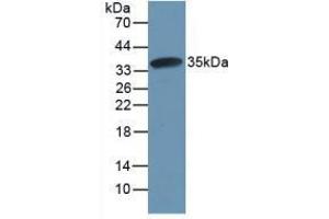Western blot analysis of recombinant Rat CAPN1. (CAPNL1 antibody  (AA 387-694))