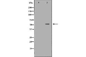Western blot analysis of Hela whole cell lysates, using IRF5  Antibody. (IRF5 antibody  (C-Term))