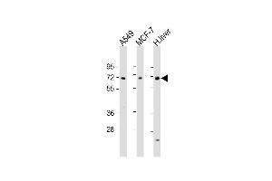 Western Blot at 1:1000-1:2000 dilution Lane 1: A549 whole cell lysate Lane 2: MCF-7 whole cell lysate Lane 3: human liver lysate Lysates/proteins at 20 ug per lane. (HABP2 antibody  (C-Term))
