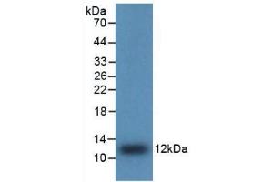 Detection of Recombinant IL8, Human using Polyclonal Antibody to Interleukin 8 (IL8) (IL-8 antibody  (AA 28-99))