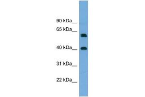 WB Suggested Anti-TERF2IP  Antibody Titration: 0. (RAP1 antibody  (Middle Region))