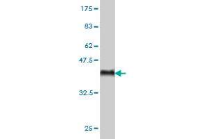 Western Blot detection against Immunogen (36. (ARAF antibody  (AA 151-250))