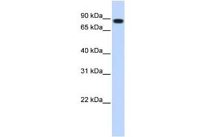 WB Suggested Anti-STAT5B Antibody Titration:  1 ug/ml  Positive Control:  Transfected 293T cell lysate
