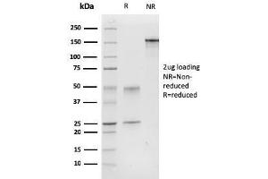 SDS-PAGE Analysis Purified Calponin-1 Mouse Monoclonal Antibody (CNN1/832).
