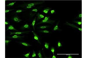 Immunofluorescence of monoclonal antibody to OXSR1 on HeLa cell. (OXSR1 antibody  (AA 351-450))