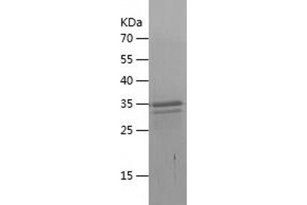 CXCL14 Protein (AA 35-111) (His-IF2DI Tag)