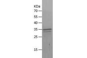 Western Blotting (WB) image for Chemokine (C-X-C Motif) Ligand 14 (CXCL14) (AA 35-111) protein (His-IF2DI Tag) (ABIN7283767) (CXCL14 Protein (AA 35-111) (His-IF2DI Tag))