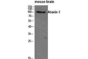 Western Blotting (WB) image for anti-Ataxin 1 (ATXN1) (Tyr1021) antibody (ABIN3173923) (Ataxin 1 antibody  (Tyr1021))