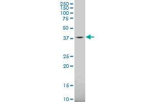 GALK1 polyclonal antibody (A02), Lot # 060707JCS1 Western Blot analysis of GALK1 expression in MES-SA/Dx5 . (GALK1 antibody  (AA 181-279))