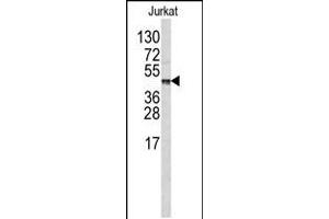Western blot analysis of in Jurkat cell line lysates (35ug/lane) (CPB2 antibody  (AA 119-148))