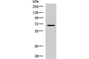 Western blot analysis of Raji cell lysate using CACNB1 Polyclonal Antibody at dilution of 1:800 (CACNB1 antibody)