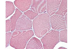 Anti-FABP3 antibody IHC of human skeletal muscle.