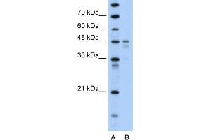 WB Suggested Anti-PDK4 Antibody Titration:  0. (PDK4 antibody  (N-Term))