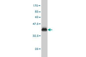 Western Blot detection against Immunogen (36. (Phenylalanyl-tRNA Synthetase, alpha Subunit (FARSA) (AA 101-201) antibody)