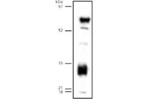Western blot analysis of LIPG on human endothelial lipase detected in transfected 293 lysates using LIPG polyclonal antibody . (LIPG antibody  (C-Term))