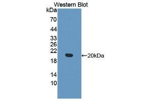 Western Blotting (WB) image for anti-Meningioma Expressed Antigen 5 (Hyaluronidase) (MGEA5) (AA 6-240) antibody (ABIN1172145) (MGEA5 antibody  (AA 6-240))