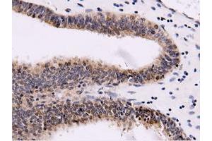 Immunohistochemical staining of paraffin-embedded Human liver tissue using anti-CBWD1 mouse monoclonal antibody. (CBWD1 antibody)