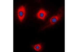 Immunofluorescent analysis of Kalirin staining in NIH3T3 cells. (KALRN antibody  (Center))