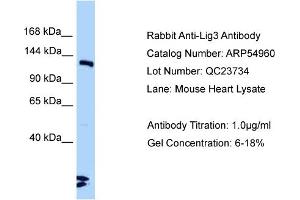 Western Blotting (WB) image for anti-Ligase III, DNA, ATP-Dependent (LIG3) (C-Term) antibody (ABIN971036) (LIG3 antibody  (C-Term))