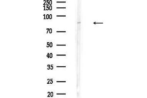 Western blot analysis of lysates from HepG2 cells(heat-shock,45 min treatment), using BBS2 Antibody at 1/1000 dilution.