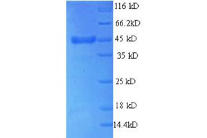 Thyroid Peroxidase (TPO) (AA 22-194) protein (GST tag) (Thyroperoxidase Protein (AA 22-194) (GST tag))