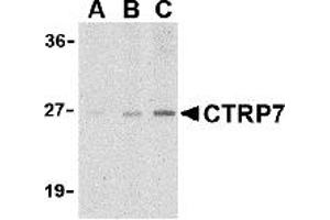 Western Blotting (WB) image for anti-C1q and Tumor Necrosis Factor Related Protein 7 (C1QTNF7) (N-Term) antibody (ABIN1031333) (CTRP7 antibody  (N-Term))