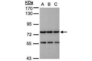 WB Image Sample(30 ug whole cell lysate) A:H1299 B:HeLa S3, C:Hep G2 , 7. (NAGLU antibody  (Center))
