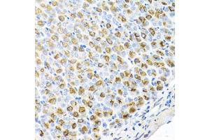 Immunohistochemistry of paraffin-embedded mouse stomach using FECH antibody (ABIN5974679) at dilution of 1/100 (40x lens). (FECH antibody)