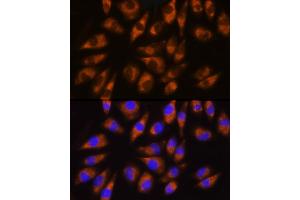 Immunofluorescence analysis of L929 cells using GRK5 Rabbit pAb (ABIN1680115, ABIN3018251, ABIN3018252 and ABIN6220413) at dilution of 1:100 (40x lens). (GRK5 antibody  (AA 371-590))