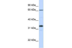 Western Blotting (WB) image for anti-UDP-Gal:betaGlcNAc beta 1,3-Galactosyltransferase, Polypeptide 1 (B3GALT1) (C-Term) antibody (ABIN635750)