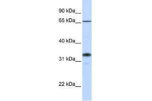 B3GALT1 antibody used at 1 ug/ml to detect target protein. (B3GALT1 antibody  (C-Term))