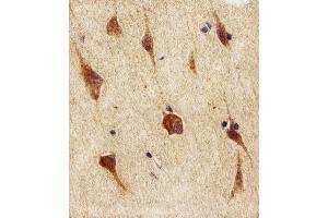 Immunohistochemical analysis of paraffin-embedded H. (NEK2 antibody  (AA 396-426))