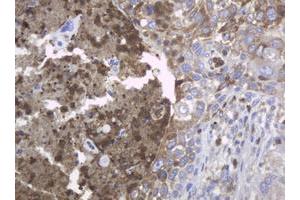 Image no. 7 for anti-Mast/stem Cell Growth Factor Receptor (KIT) (AA 546-976) antibody (ABIN1491585)