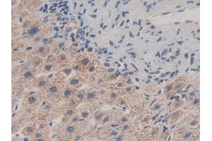 Detection of MAPKAPK2 in Human Liver Tissue using Polyclonal Antibody to MAP Kinase Activated Protein Kinase 2 (MAPKAPK2) (MAPKAP Kinase 2 antibody  (AA 139-367))