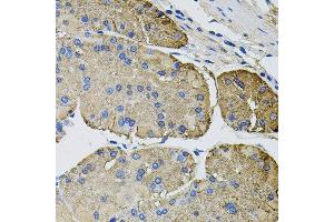 Immunohistochemistry of paraffin-embedded human stomach using THBS2 antibody at dilution of 1:100 (x40 lens).