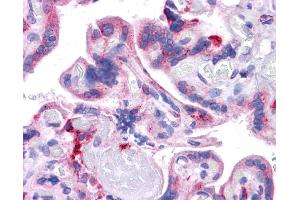 Immunohistochemistry (IHC) image for anti-KIT Ligand (KITLG) (Middle Region) antibody (ABIN2781827) (KIT Ligand antibody  (Middle Region))
