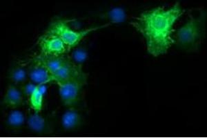 Immunofluorescent staining of COS7 cells transiently transfected by pCMV6-ENTRY FCGR1A with FCGR1A monoclonal antibody, clone 3D3 .