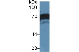 Western Blot; Sample: Human A431 cell lysate; Primary Ab: 2µg/ml Rabbit Anti-Human NUMB Antibody Second Ab: 0.