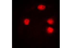 Immunofluorescent analysis of ZIC1/2/3 staining in Jurkat cells. (ZIC1/2/3 antibody  (Center))