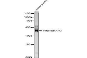 Western blot analysis of extracts of Human plasma, using Kallistatin (SERPIN) Rabbit pAb antibody (ABIN6131346, ABIN6147573, ABIN6147574 and ABIN6223161) at 1:500 dilution.