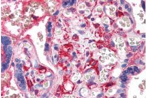 Human Placenta (formalin-fixed, paraffin-embedded) stained with PF4 antibody ABIN351496 at 5 ug/ml followed by biotinylated secondary antibody, alkaline phosphatase-streptavidin and chromogen. (PF4 antibody)