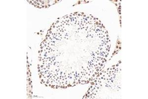 Immunohistochemistry (Paraffin-embedded Sections) (IHC (p)) image for anti-Polyglutamine Binding Protein 1 (PQBP1) antibody (ABIN7075126)