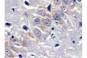 DAB staining on IHC-P; Samples: Rat Cerebrum Tissue (DMPK antibody  (AA 1-152))