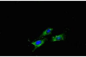 Immunofluorescent analysis of Hela cells using ABIN7144042 at dilution of 1:100 and Alexa Fluor 488-congugated AffiniPure Goat Anti-Rabbit IgG(H+L)